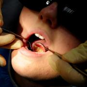 Dozens of hospital admissions in Dudley to remove children's rotten teeth